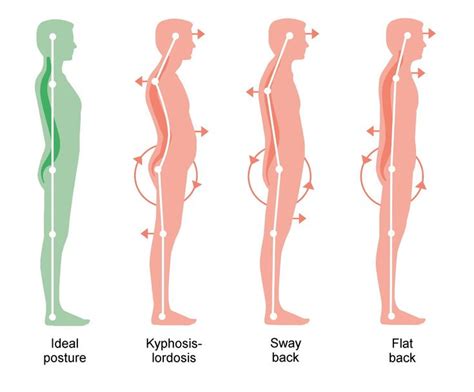 Fix Forward Head Posture With Pandiculation Somatic Movement Center