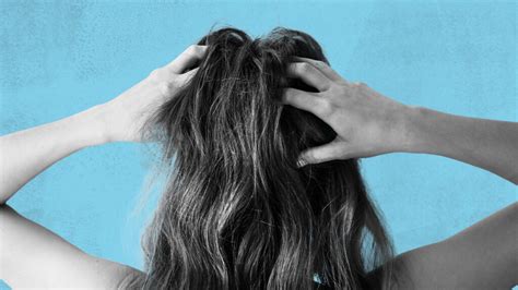 Itchy Scalp And Hair Loss Link Causes And Treatment