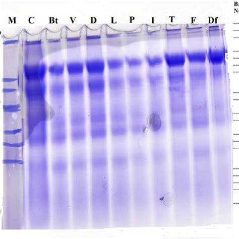 Sds Polyacrylamide Gel Of Denatured Protein Patterns In The Whole Body Download Scientific