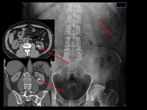 Ppt Approach To Abdominal Plain Film Radiology Powerpoint Presentation Id192354