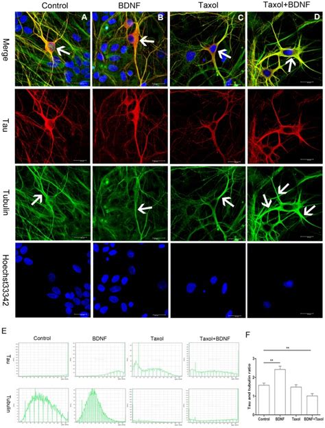 A Tau Protein Distribution In Control E Hippocampal Neurons Arrow