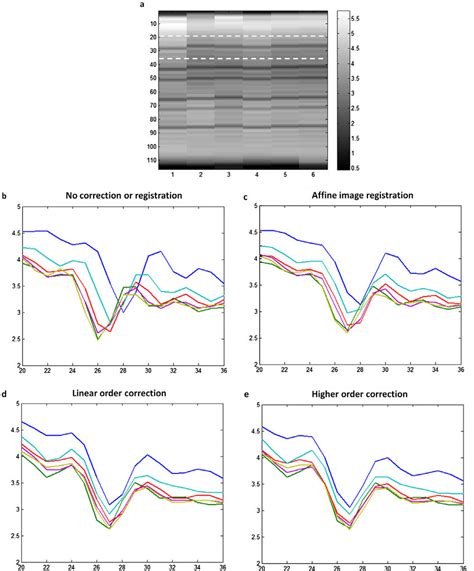 Comparison Between Registration And Eddy Current Correction Intensity