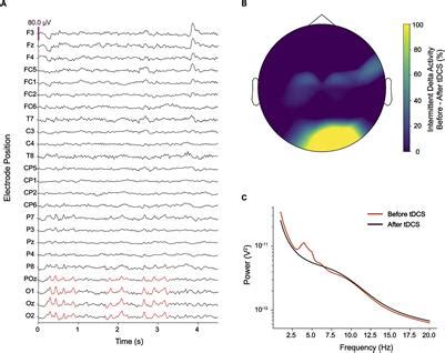 Frontiers Pathological Delta Oscillations In Hallucinogen Persisting