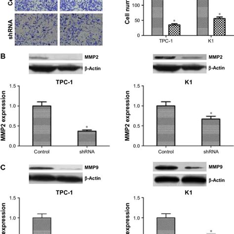 Downregulated Expression Of Nucb Inhibited The Migration And Invasion