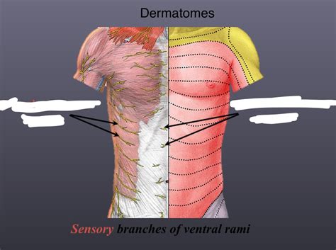 Dermatomes Diagram Quizlet