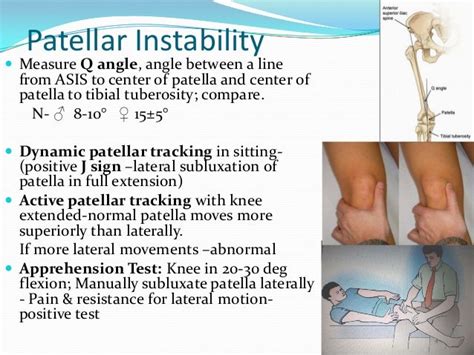 Knee Examination