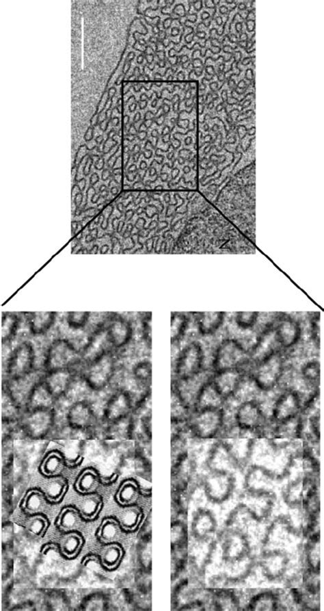 Sequestration Of Sinusoidal And Whorled Oser In Large Vacuoles Large