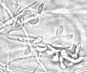 Geomyces Destructans Microbewiki