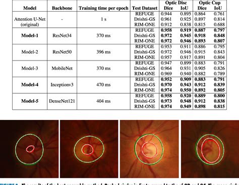 Figure From Glaucoma Identification Using Convolutional Neural