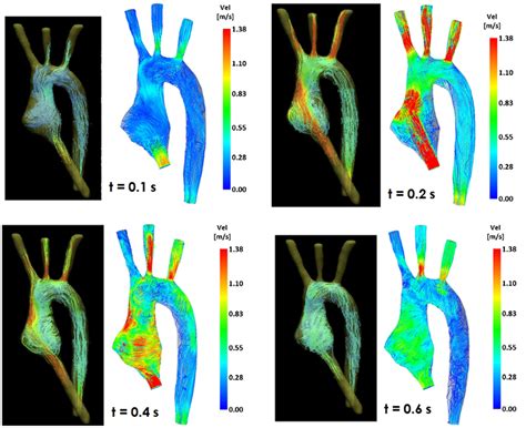 Frontiers Using 4d Cardiovascular Magnetic Resonance Imaging To