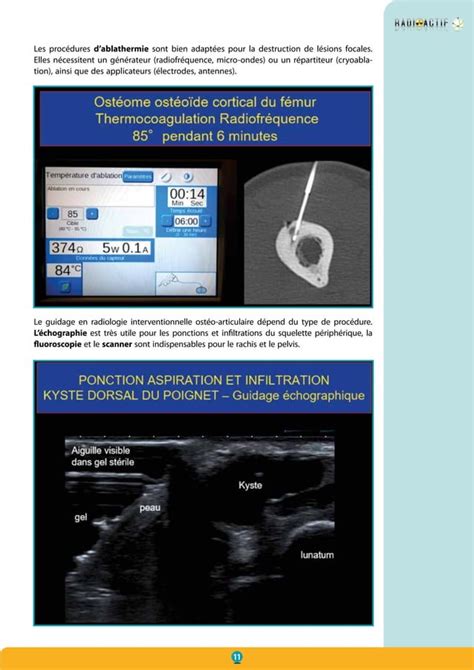 Radiologie Interventionnelle Ost O Articulaire Pdf