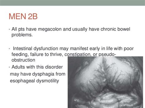 Men syndromes