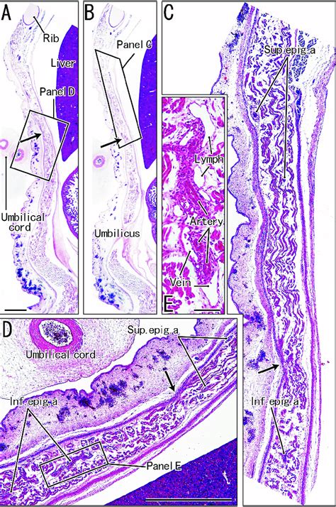 Superior And Inferior Epigastric Arteries In Sagittal Sections Of A