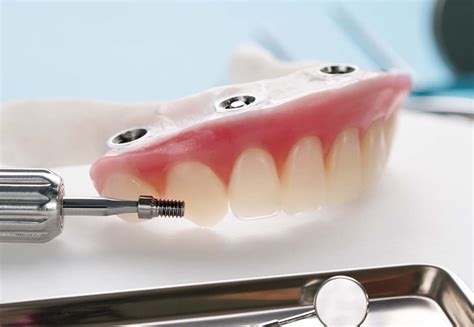 Dentures In Prince George Hart Dental