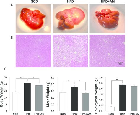 AM Prevents HFD Induced Intrahepatic Lipid Accumulation And Weight