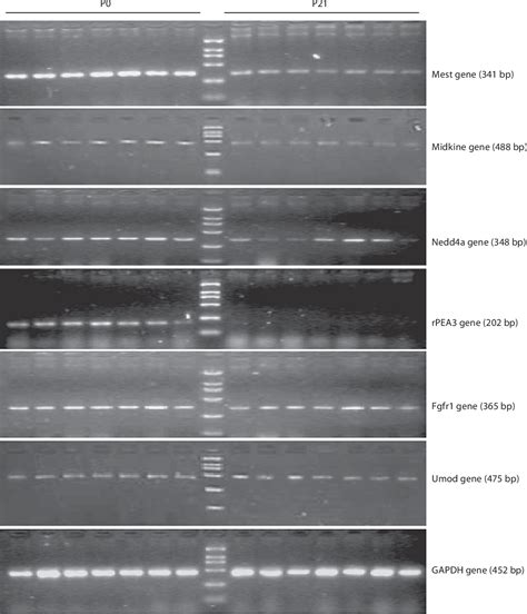 Figure 3 From Suppression Subtractive Hybridization Analysis Of Gene