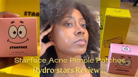 Starface Acne Pimple Patches Hydro Stars Review Youtube