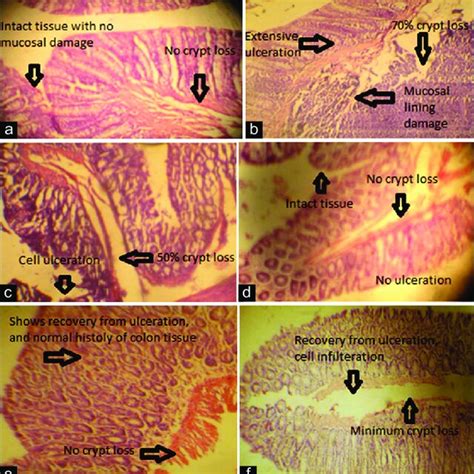 Photomicrograph of the colon tissue of (a) normal control showing the ...