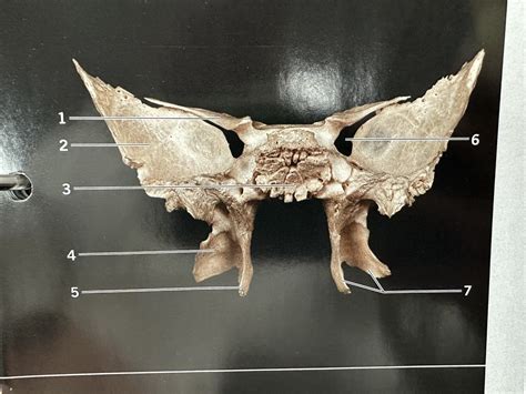 Sphenoid Bone Posterior Bone Diagram Quizlet