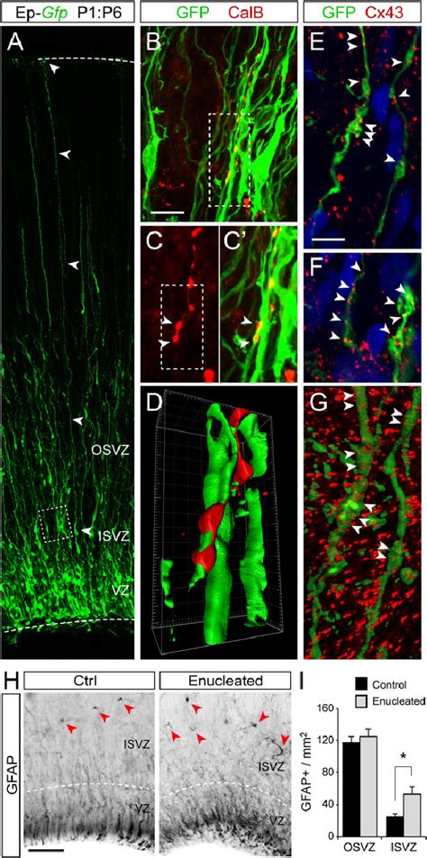 Interaction Between Axons And RGCs In The Developing Ferret Cerebral