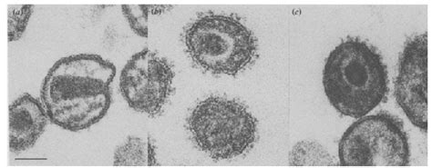 Electron Microscopy Hiv