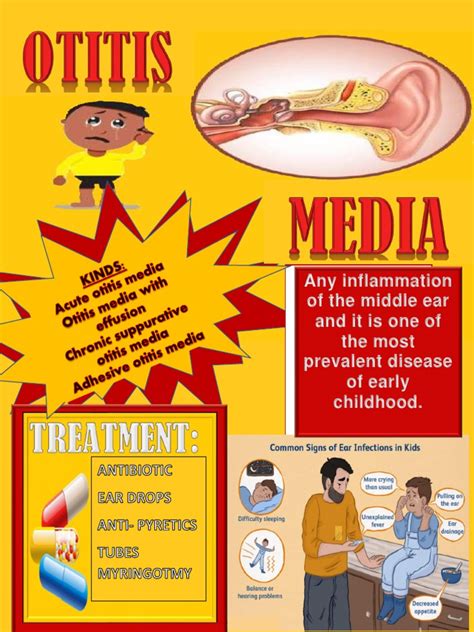 Otitis Media | PDF