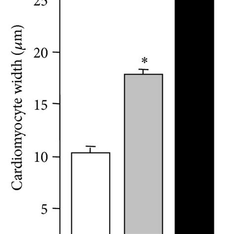 Exercise Training Improves Myocardial Contractility In Hypertensive