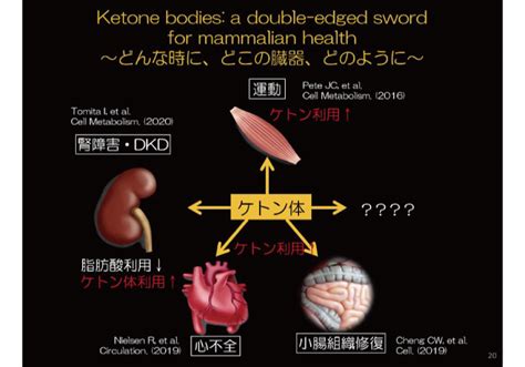 ケトン体は諸刃の剣、使い方次第で臓器保護｜学会レポート｜その他診療領域ワーク・ライフ｜医療ニュース｜medical Tribune