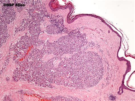 Hsp Atlas Histopathology Atlas Heart And Vessels