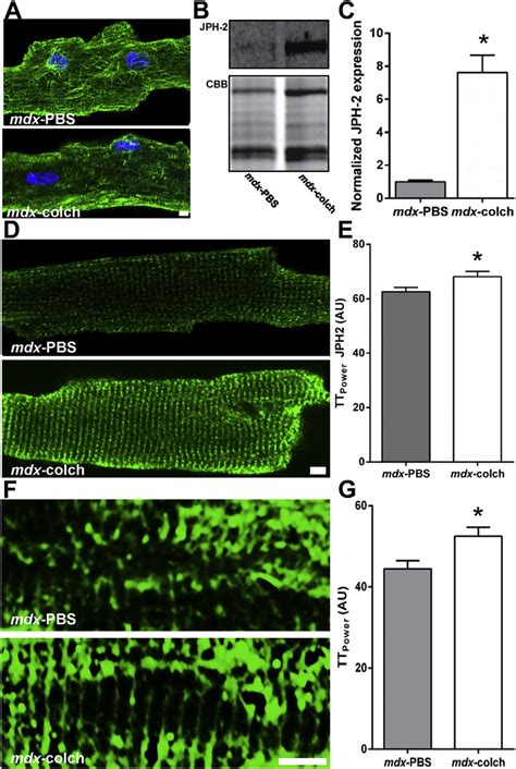 Microtubule Depolymerization Normalized JPH 2 Levels And Localization