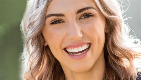 Ventajas De La Ortodoncia Invisible Invisalign Y Spark