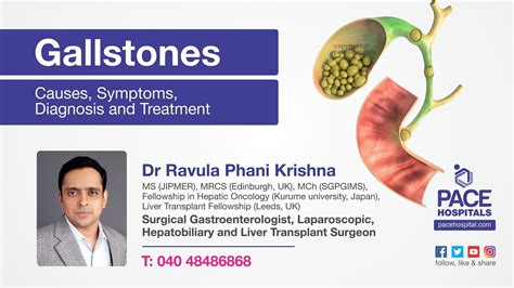 Gallstones Causes Symptoms Diagnosis And Treatment Dr Ravula Phani