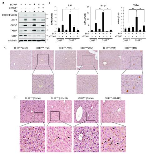 CHIP Mediated TXNIP Regulation Is Responsible For ER Stress And