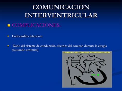 Comunicación Interventricular Ppt