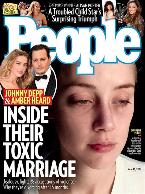 Revista Divulga Novas Fotos De Amber Heard Ap S Agress O De Johnny Depp