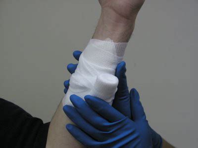 Артеріальна кровотеча - як зупинити накладенням джгута, перша допомога ...