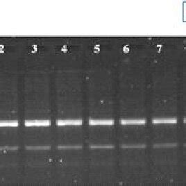 Multiplex PCR Showing PCR Amplification Of Orobanche DNA Isolated From