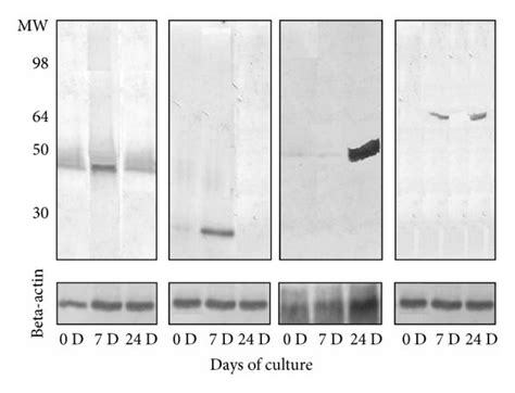 Western Blot Analysis Of Protein Expression A B And C Show