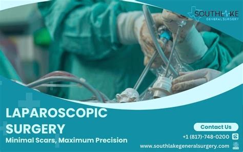 Laparoscopic Surgery Minimal Scars Maximum Precision R Laparoscopy