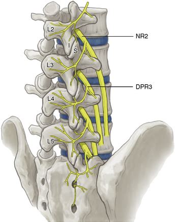 medial branch block  radiofrequency lesioning neupsy key