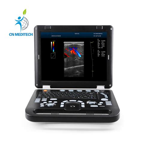 Medical Diagnostic Ultrasound Portable Color Doppler Echo Laptop