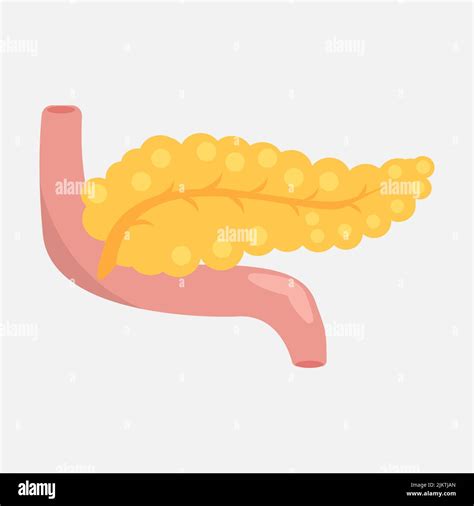 Pankreas Krankheit Stock Vektorgrafiken Kaufen Alamy
