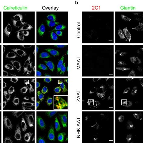 Time Course Of Changes In Intracellular Calcium Signaling In Cho K