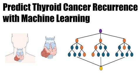 Predict Thyroid Cancer Recurrence With Machine Learning A Coding