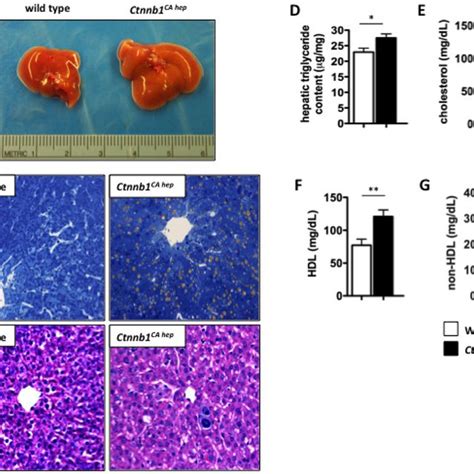 Ctnnb Ca Hep Mice Display Hepatic Steatosis Livers Of Ctnnb Ca Hep