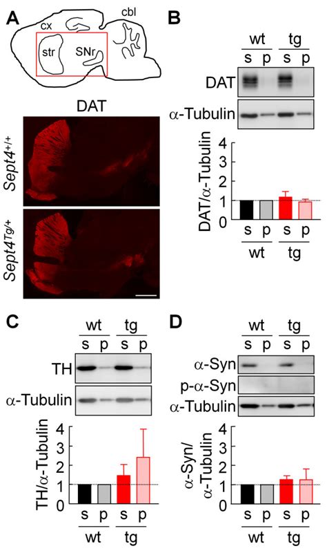 Expression Of The Two Major Proteins For Dopamine Metabolism And