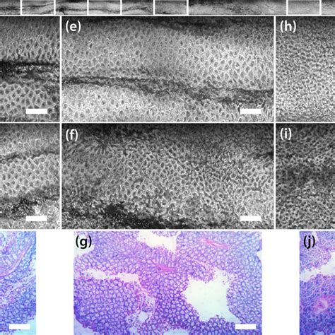 Extended Confocal Microscopy And Histology Images Of Mouse Colon With