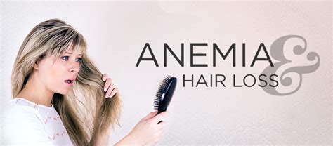 Iron Deficiency Anemia And Hair Loss