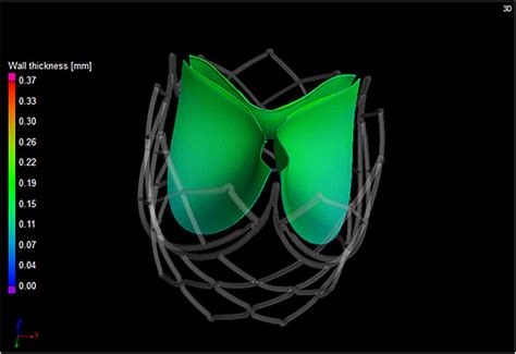 Medical Device Characterization A Polymer Heart Valve Leaflet Download Scientific Diagram