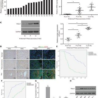 Robo Was Highly Expressed In Hcc Tissues And Cells A The Expression